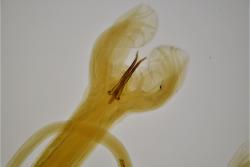 The image shows the posterior end of a male Haemonchus contortus parasite. The dark-coloured sharp ‘spicules’ assist in copulation, and allow microscopic identification of the worm in the laboratory